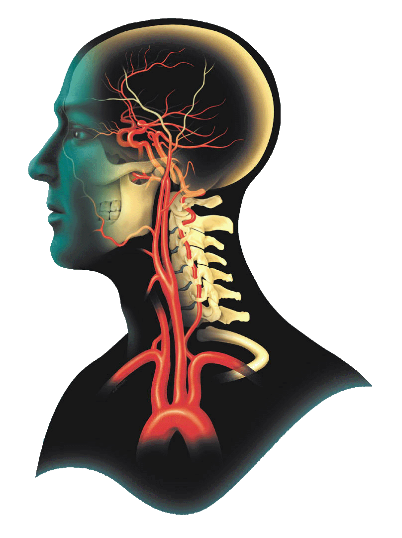 Hirnversorgende Gefäße